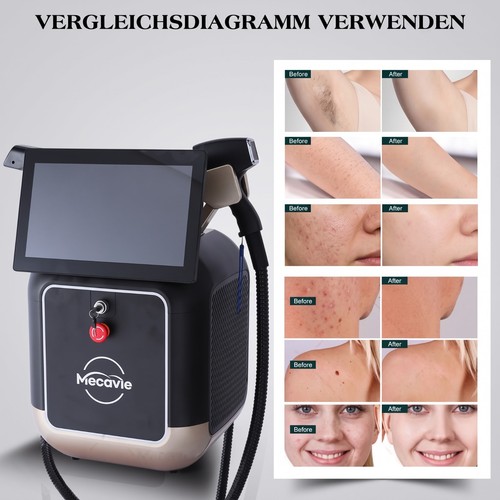 Diode laser hair - diode,